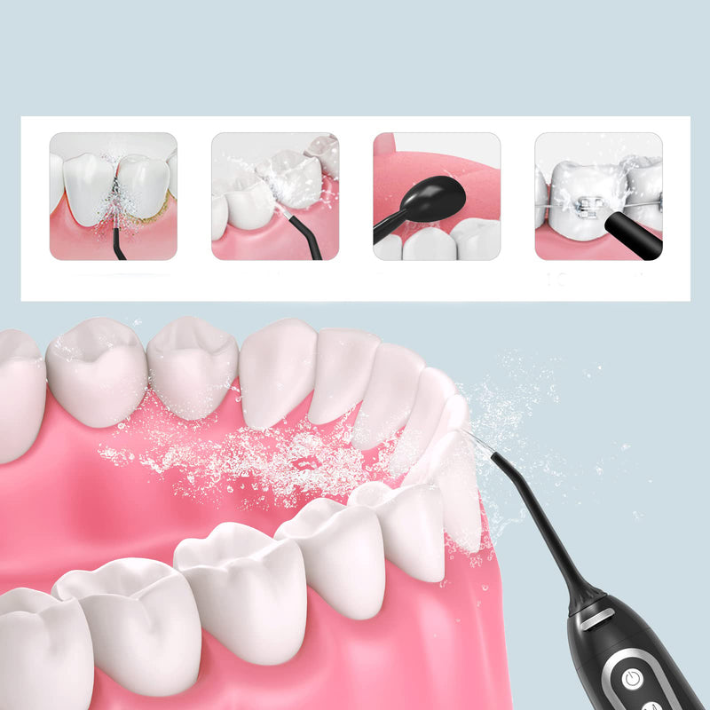 Water Jet Flosser